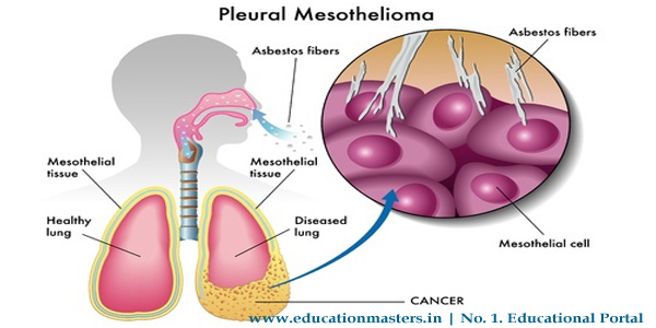 what-is-mesothelioma-mesothelioma-insurance-and-lawyer